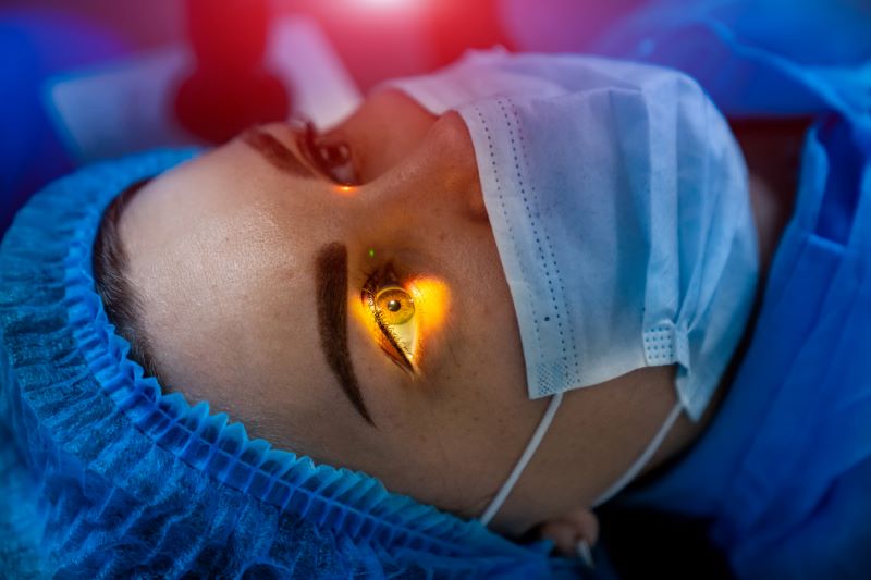 LASIK